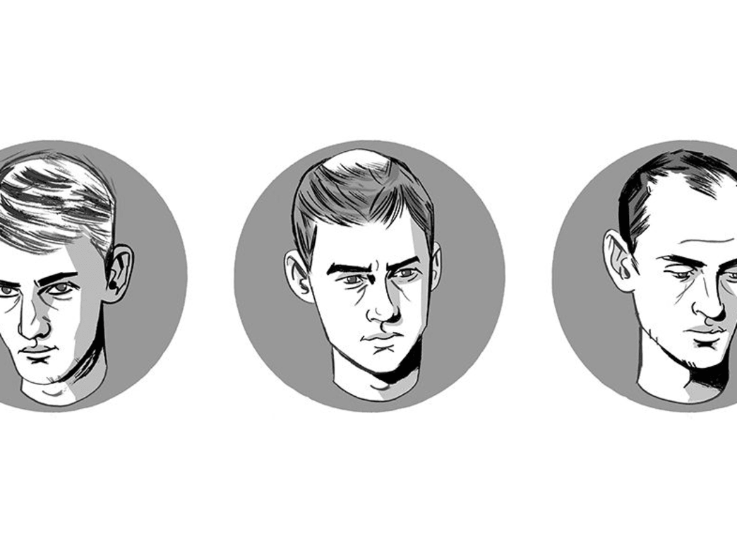 What To Do About Hair Loss